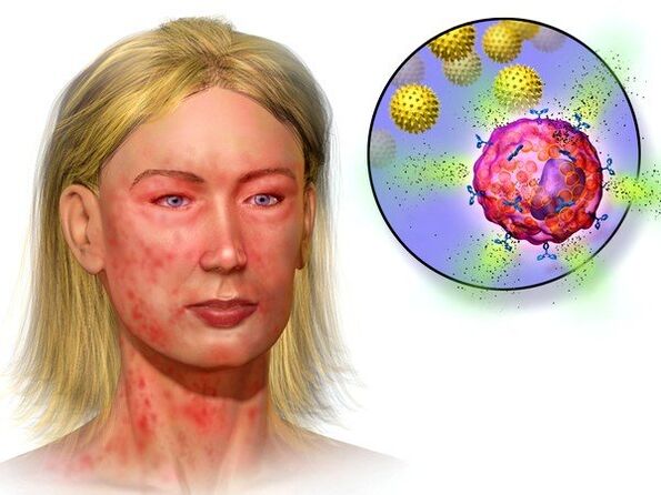 echinococcusok és jelenlétük tünetei a szervezetben